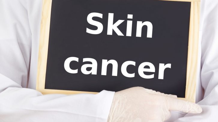 Alternative Skin Cancer Treatments in Maryland