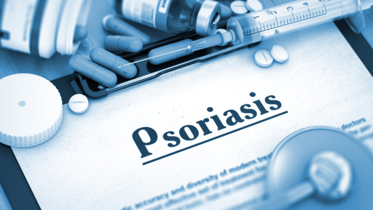 psoriasis maryland