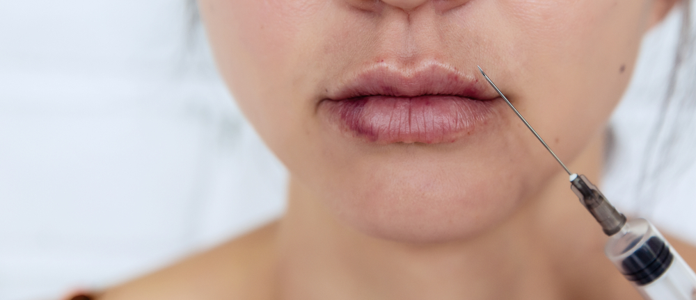 Lip Injections Maple Ridge