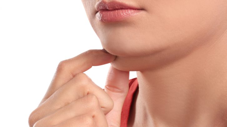 Kybella Double Chin