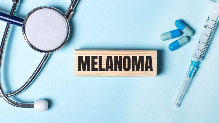 Do I Have Melanoma? - Mid-Atlantic Skin Surgery Institute