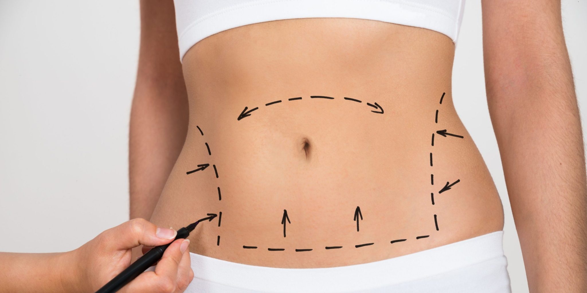 Best Liposuction Results In Maryland Mid Atlantic Skin Surgery Institute