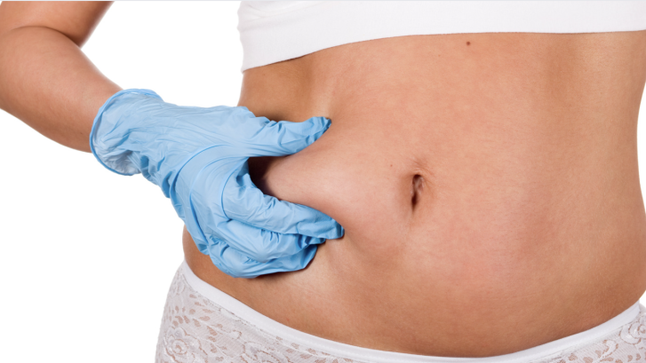liposuction for stomach