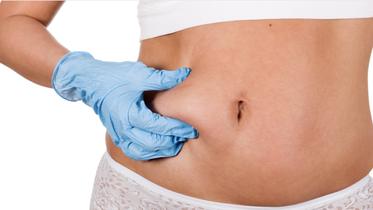 Liposuction For Stomach Cost in Prince Frederick - Mid-Atlantic Skin  Surgery Institute