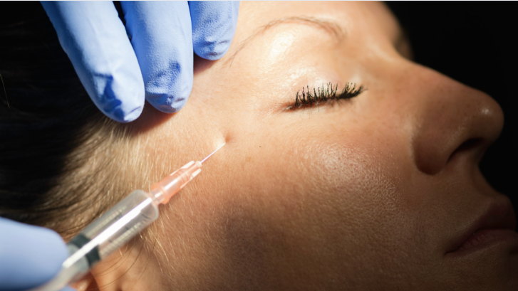 best botox areas