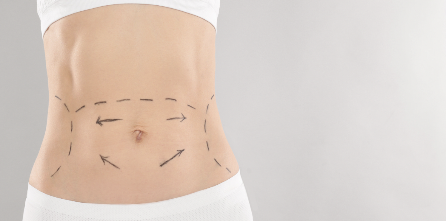 What Are the Different Types of Lipo in Frederick MD? - Hagerstown