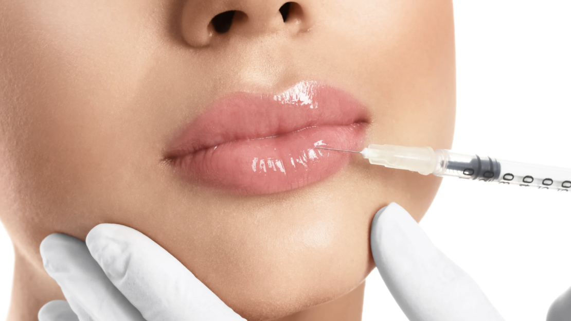 SameDay Lip Filler in Lexington Park MidAtlantic Skin Surgery Institute