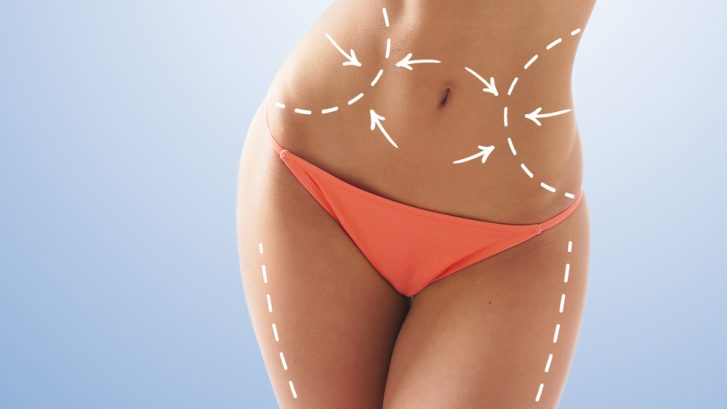 How Much Does Liposuction Cost in Owings Maryland?