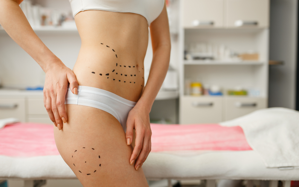 Best Liposuction Surgeon in Waldorf