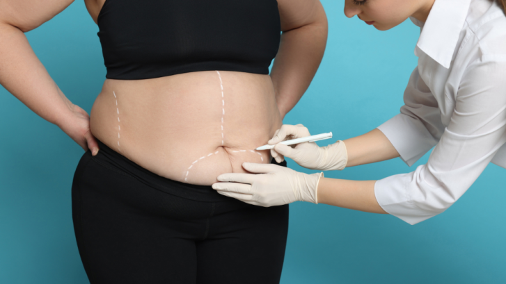 Liposuction Cost in Prince Frederick