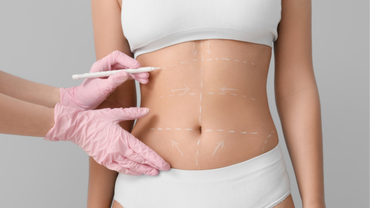 Liposuction Options in Southern Maryland