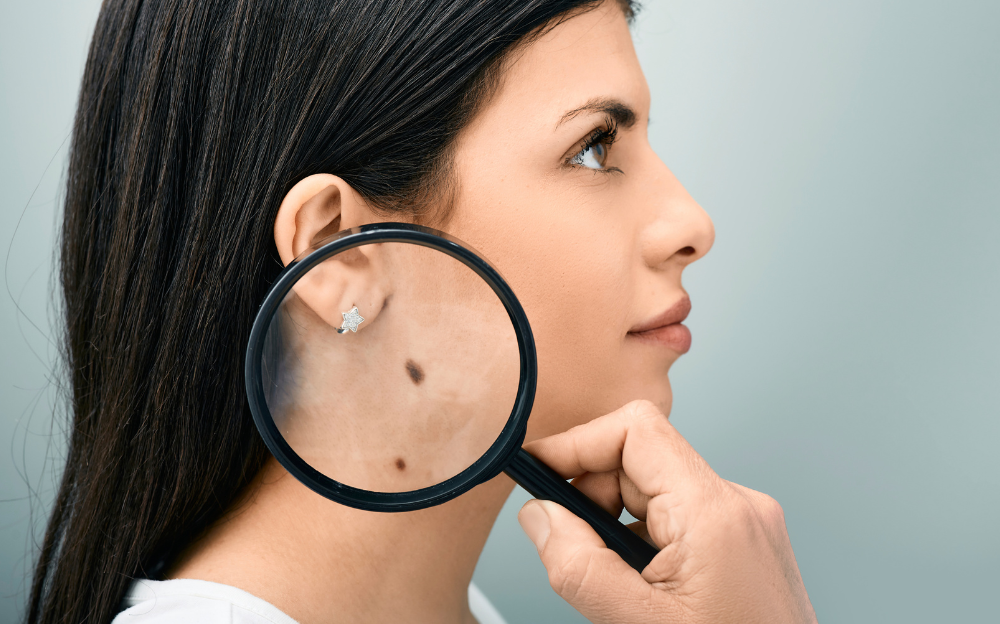 Emergency Dermatology Appointments Available in Leonardtown, MD for Urgent Skin Concerns