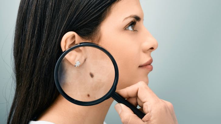 Emergency Dermatology Appointments Available in Leonardtown, MD for Urgent Skin Concerns