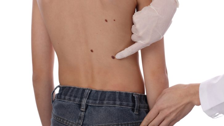 Best Dermatology Clinic for Kids Near Calvert County, Maryland: Choosing a Teen Acne Specialist