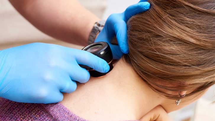 Skin Cancer Screening Clinics in Leonardtown