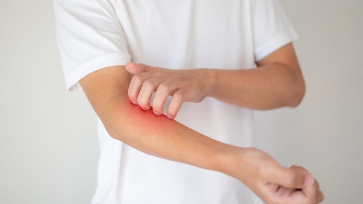 Roadmap to a Productive Psoriasis Treatment Dermatology Appointment in Huntingtown, Maryland