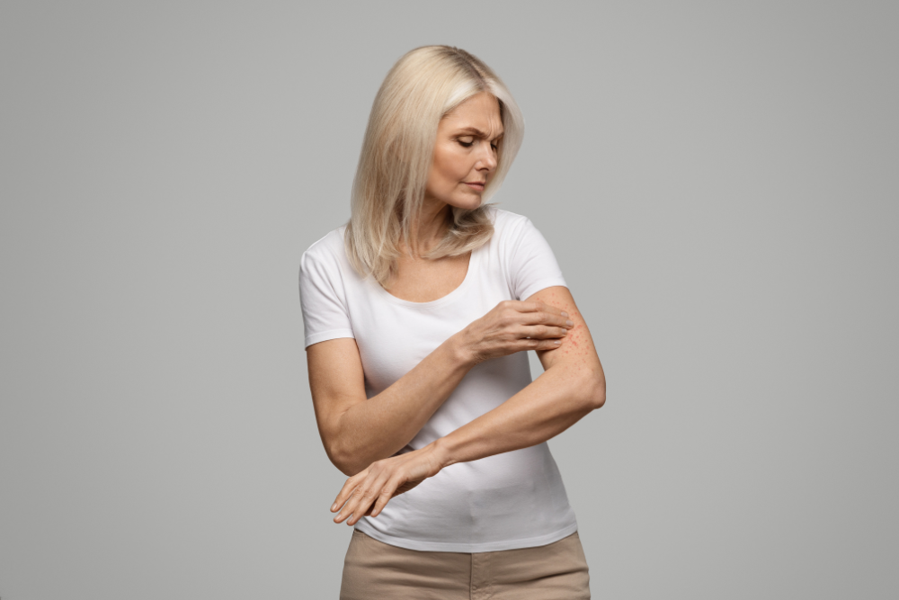 Don't Wait for Relief: Book an Eczema Flare-Up Treatment and Same-Day ...