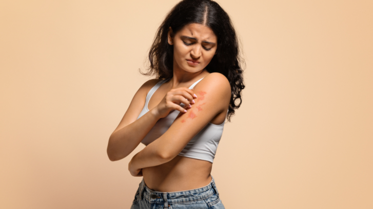 Psoriasis Treatment Options and Dermatologist Appointments in Owings, MD