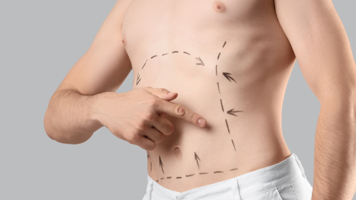 Best Affordable Liposuction Options and Surgeon Comparisons Near La Plata, MD