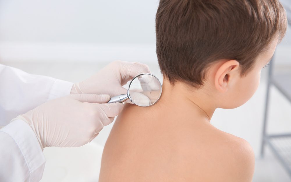 Does Your Child Need a Pediatric Dermatology Appointment Near Prince Frederick, Maryland?