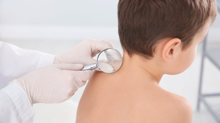 Does Your Child Need a Pediatric Dermatology Appointment Near Prince Frederick, Maryland?