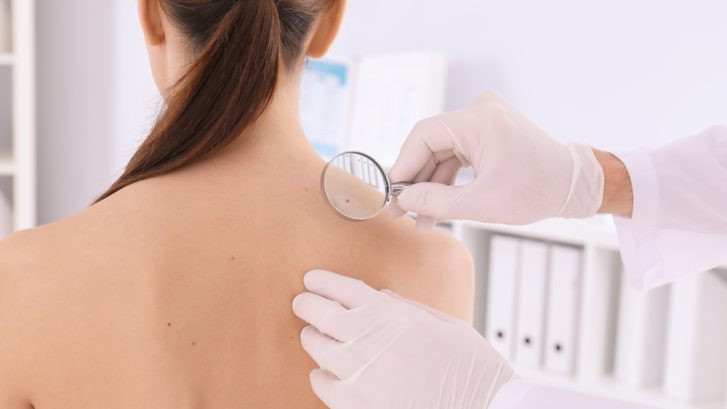 Best Dermatologist Near Chesapeake Beach Maryland for Skin Checks and Acne