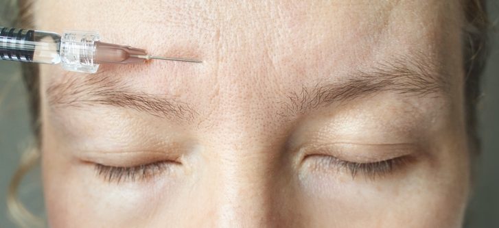 Full Facial Balancing With Botox and Filler Near Huntingtown, Maryland: The Art of Looking Refreshed, Not “Done”
