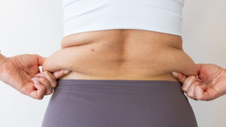 Liposuction for Stubborn Fat Near California, Maryland