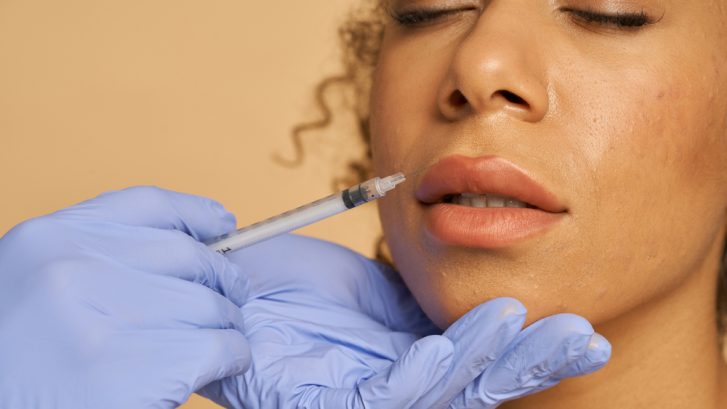 Natural Looking Dermal Fillers Near Bryans Road, MD: Where to Schedule