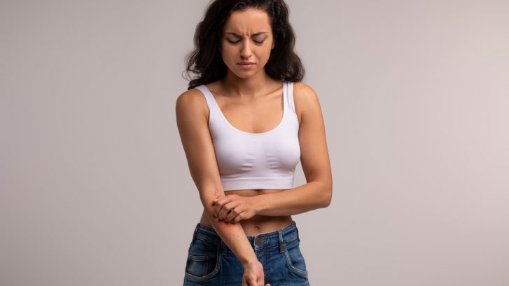 Severe Eczema Symptoms in Owings: When to See a Dermatologist