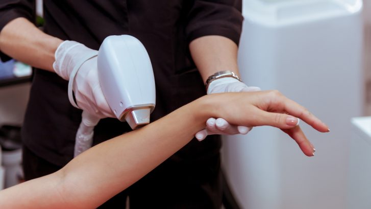 Laser Hair Removal Consultation Near St. Charles, Maryland: How Many Treatments Are Needed?