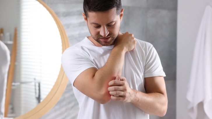 Dermatology Appointment for Chronic Itchy Skin Near Chesapeake Beach, MD: What You Should Know
