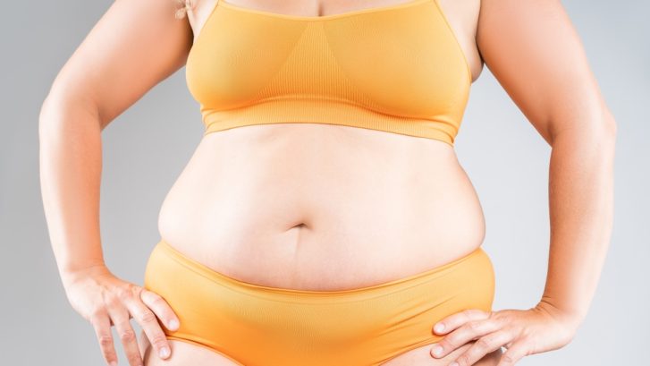Best Liposuction Results Near Prince Frederick Maryland