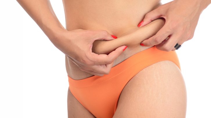 Liposuction Near Waldorf, Maryland: Cost and Best Results