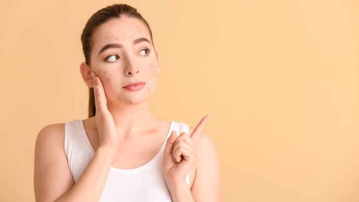 Acne Treatment Near Prince Frederick, Maryland: Find the Best Acne Doctor Accepting New Patients