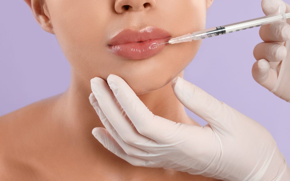 Lip Filler Treatments in Leonardtown, MD for Natural Looking Lips