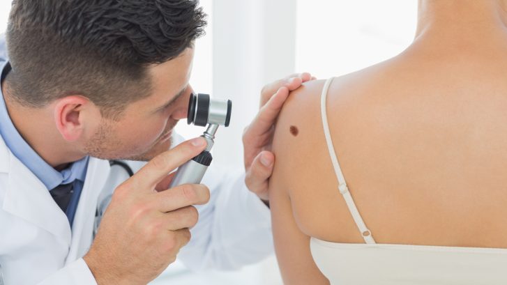 Free Skin Cancer Consultations in Chesapeake Beach, MD