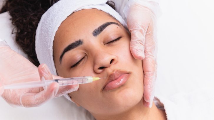 Mini Lip Filler Treatments in California, MD for Natural Volume