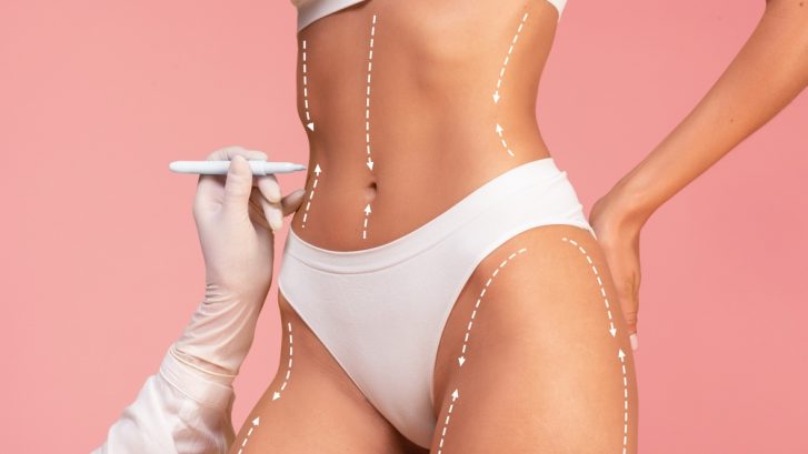 Best Liposuction Results in Southern Maryland: How to Achieve Safe, Natural-Looking Body Contouring