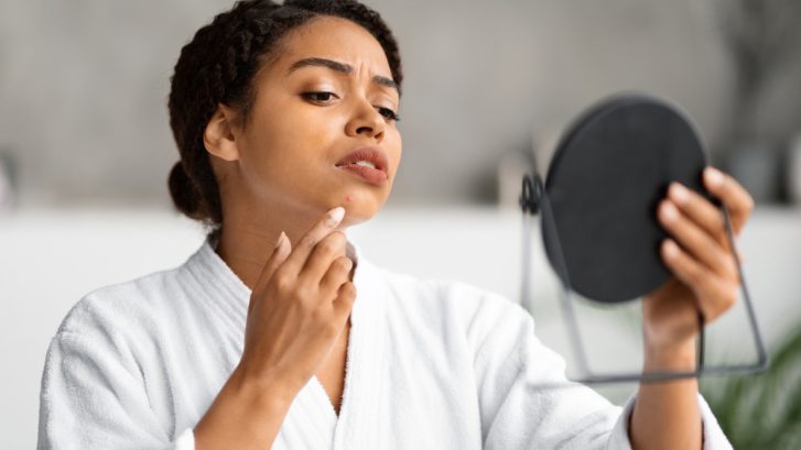 Same-Day Dermatology Appointments in Dunkirk, MD for Persistent Acne and Skin Concerns