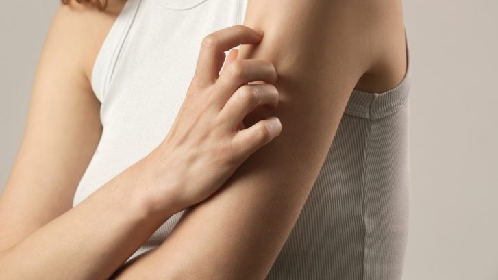 Skin Rash Diagnosis and Treatment in Huntingtown, MD for Adults and Children