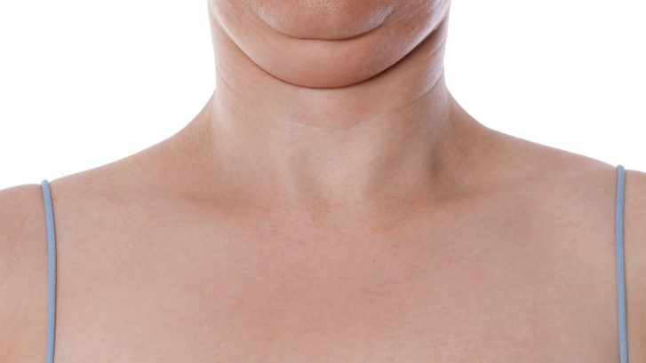 How Much Does Double Chin Treatment Cost in Southern Maryland? Kybella, Liposuction, and Skin Tightening Explained